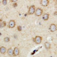 RIMS4 Antibody (Internal)