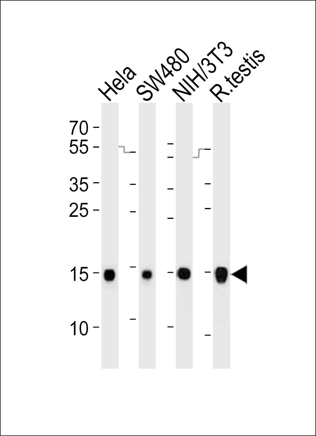 UBE2D2 / UBCH5B Antibody (aa44-76)