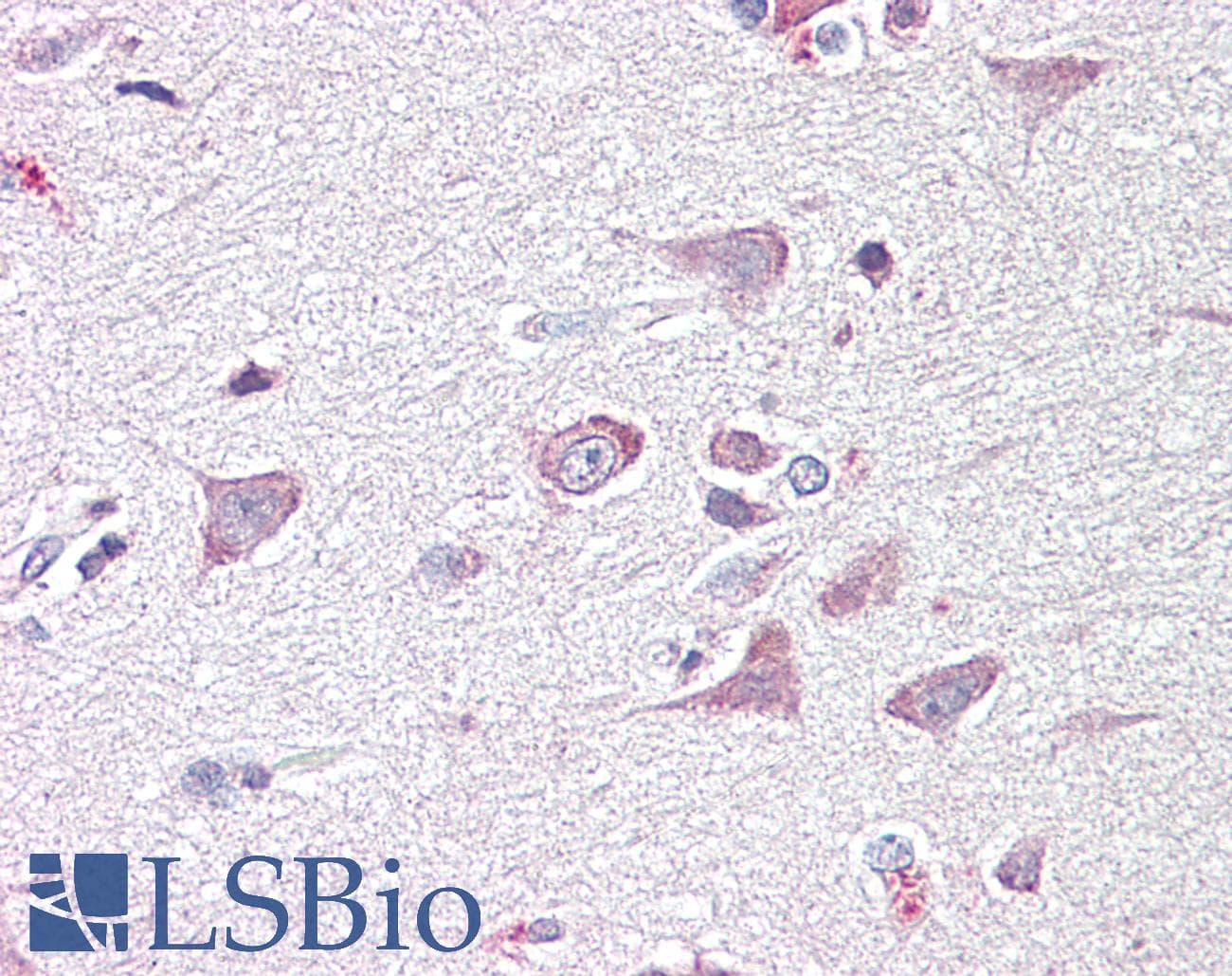 IHC-plus™ GOLGA6A Antibody (aa536-547)