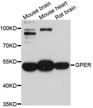 Polyclonal Rabbit anti-Human GPER1 / GPR30 Antibody (WB)