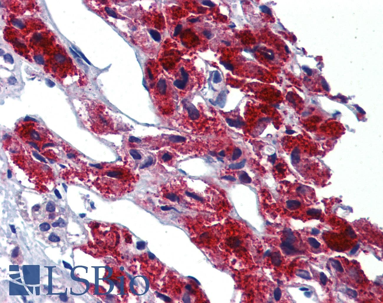 IHC-plus™ LRRN4 / C20orf75 Antibody (N-Terminus)