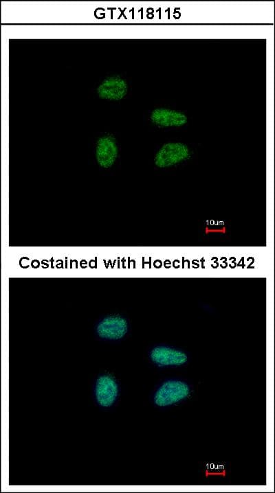 GAS41 Antibody