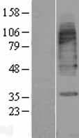 SLC6A11 / GAT-3 Protein (Over-Expression Lysate Myc-DDK (Flag))