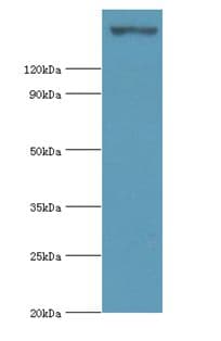 GCN2 Antibody (aa1-300)