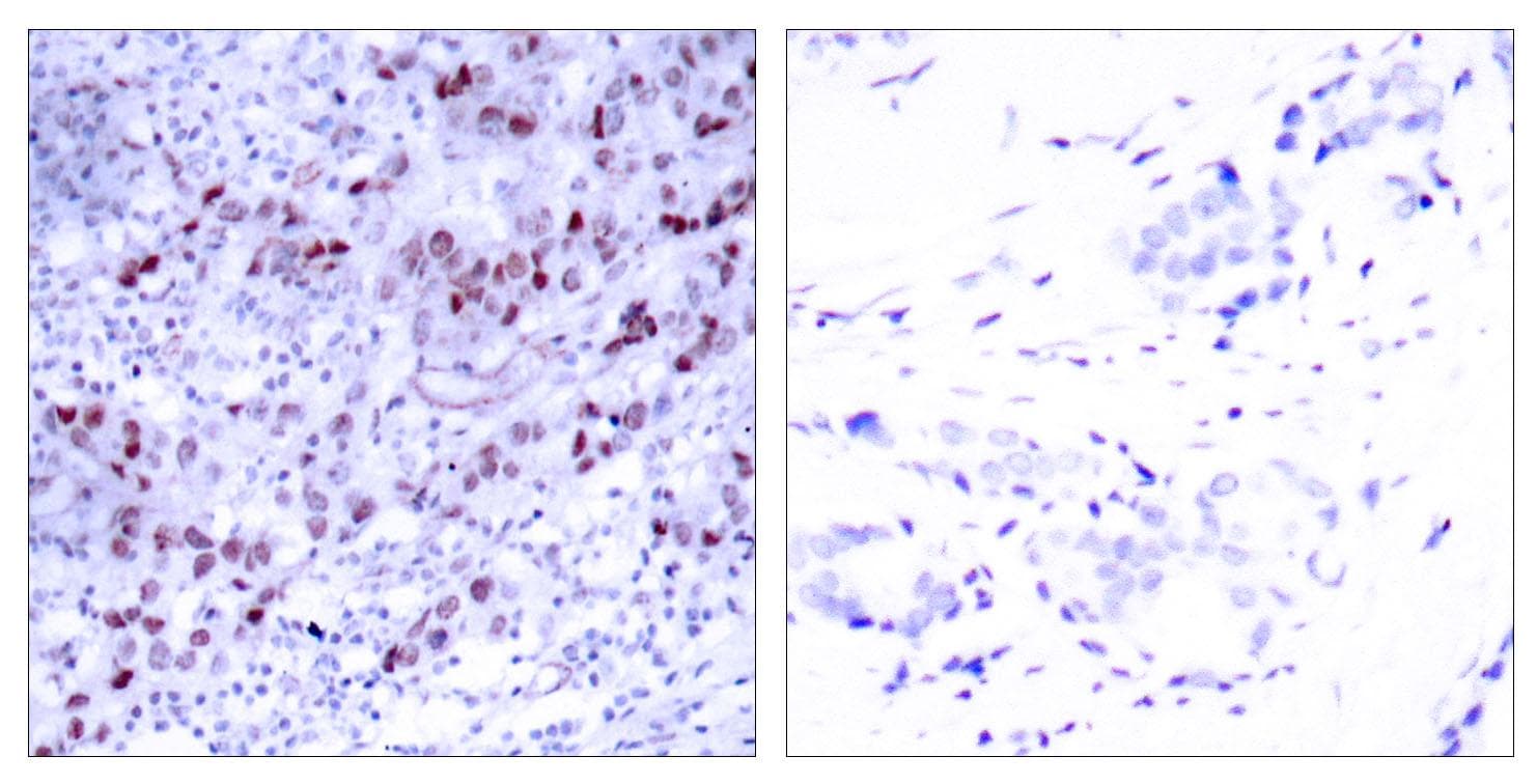 GATA1 Antibody (p142)