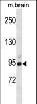 Polyclonal Rabbit anti-Human KIAA1811 / BRSK1 Antibody (aa355-384, WB)