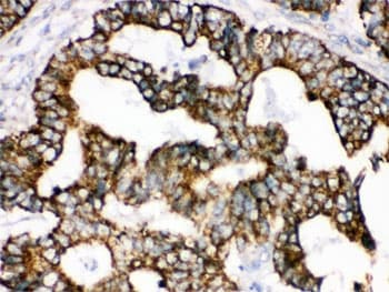 TRAP1 / HSP75 Antibody