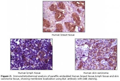 BLK Antibody (clone 9D10D1)