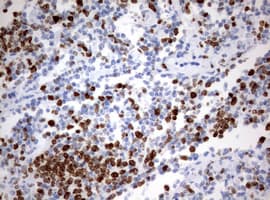 MKI67 / Ki67 Antibody (aa1160-1493, clone OTI8B11)