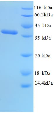 Salmonella typhi ompA Protein (Recombinant His)