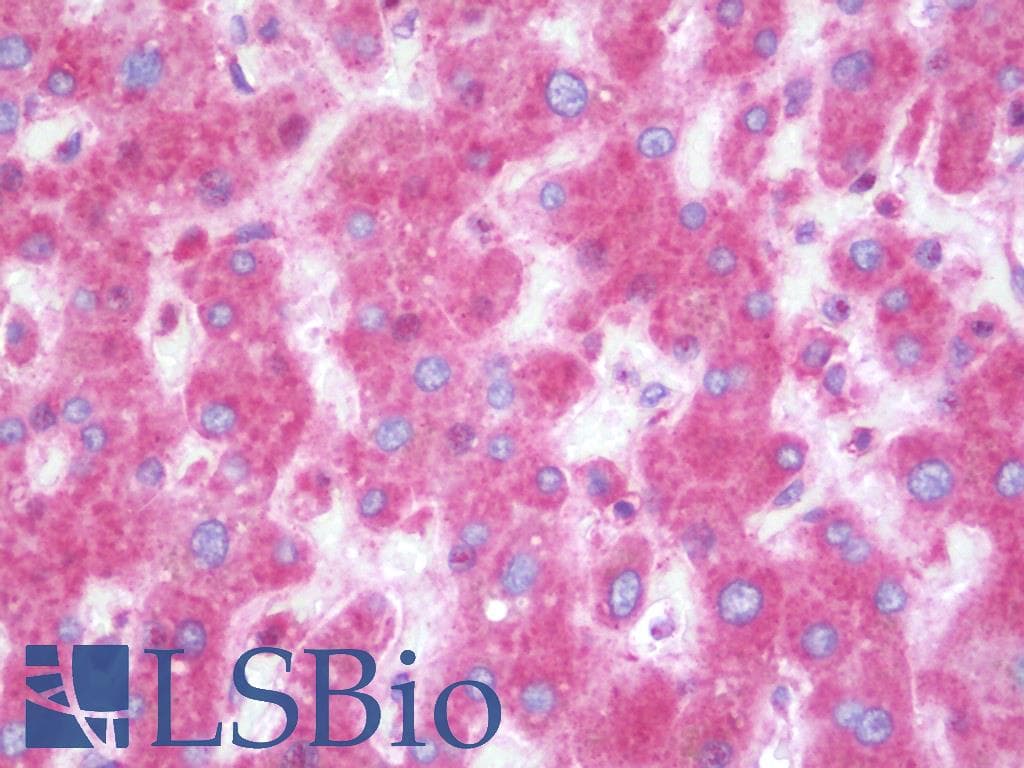 IHC-plus™ Polyclonal Rabbit anti-Human DAP Antibody (IHC, IF, WB)