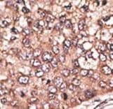 CCN4 / WISP1 Antibody (aa171-200)