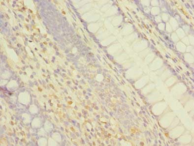 Polyclonal Rabbit anti-Human ABCF3 Antibody (IHC)
