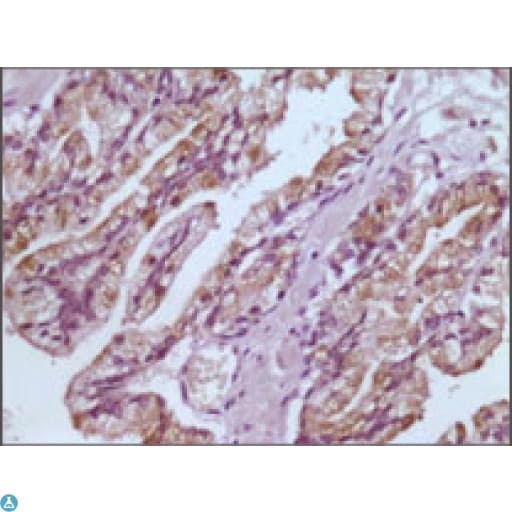GSTP1 / GST Pi Antibody