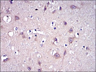 MMP9 / Gelatinase B Antibody (clone 5G3)