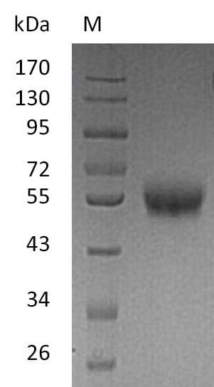 Human TNFRSF9 / 4-1BB / CD137 Protein (Recombinant Fc-6His, C-terminus)