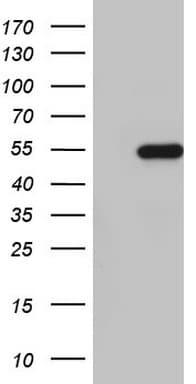 NKX2-1 / Thyroid-Specific TF Antibody (clone OTI13F3)