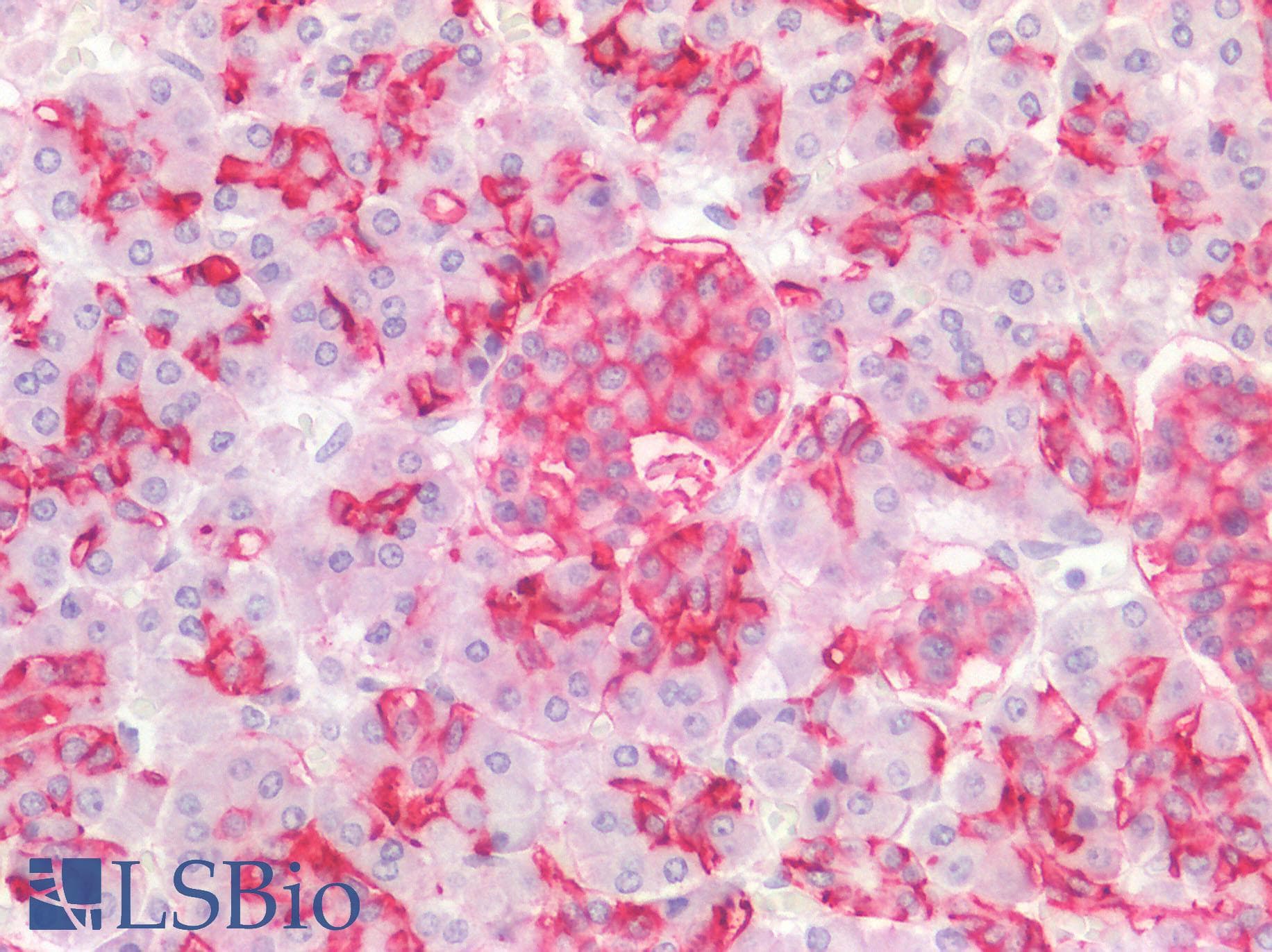 PathPlus™ Monoclonal Mouse anti-Human IL17A Antibody (clone 4K5F6, aa1-75, IHC, WB)