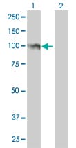 FOXM1 Antibody (clone 3A9)