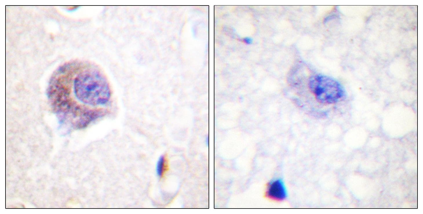 FAK / Focal Adhesion Kinase Antibody (p407)