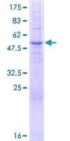 Human SLC25A35 Protein (Recombinant GST)