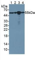 TUBB / Beta Tubulin Antibody (APC)