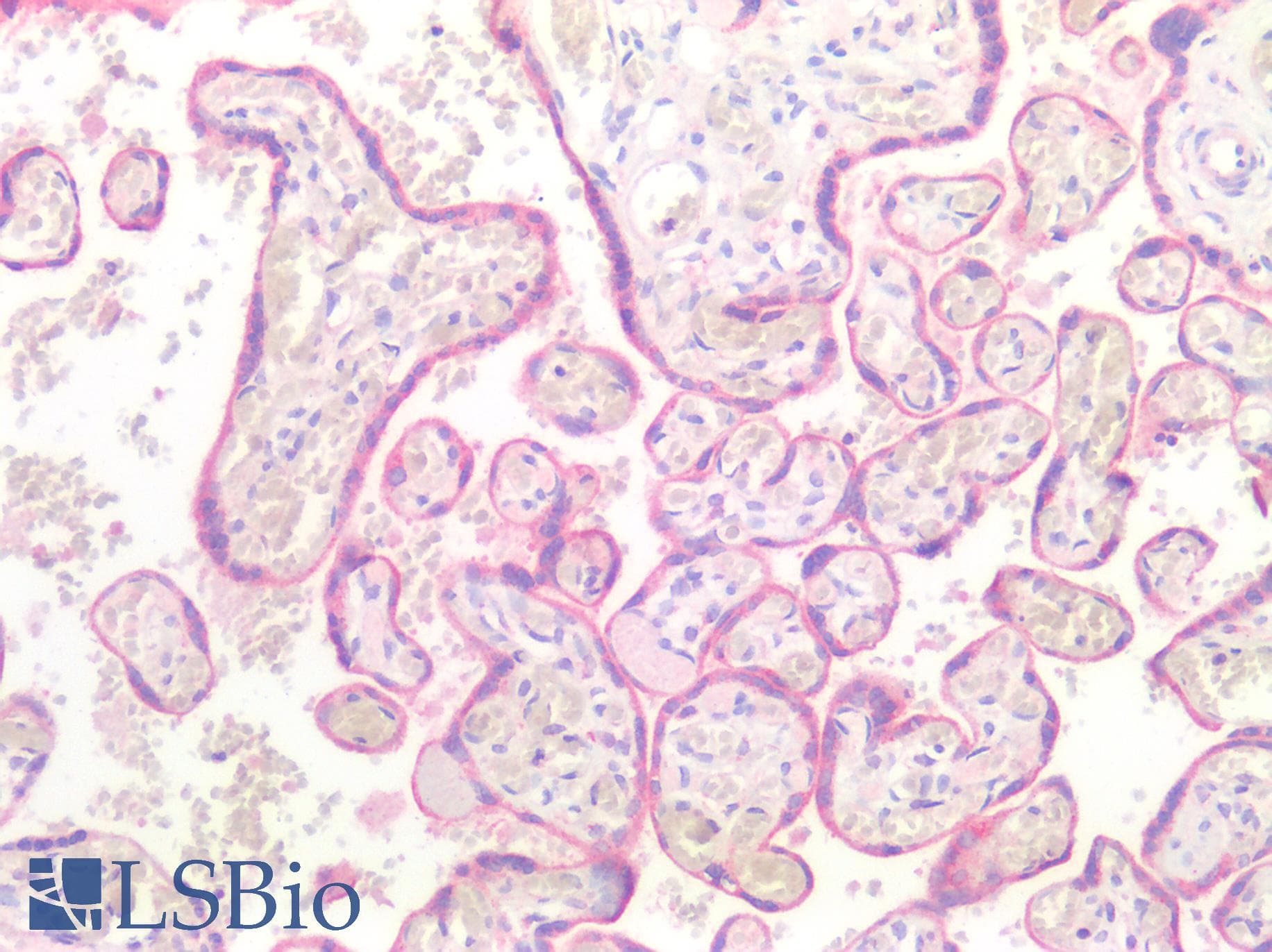 IHC-plus™ BCL2 / Bcl-2 Antibody