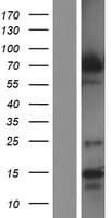 DYRK1B Protein (Over-Expression Lysate Myc-DDK (Flag))