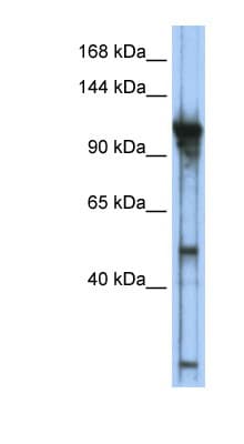 GTF3C2 Antibody (aa755-804)