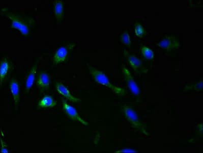 Polyclonal Rabbit anti-Human RNF148 Antibody (IHC, WB)