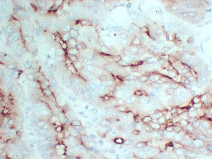 CEACAM5 / CD66e Antibody (clone ABT-CEA)
