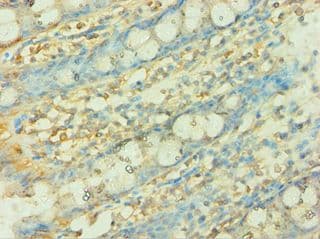 IHC-plus™ CISH / SOCS Antibody (aa1-257)