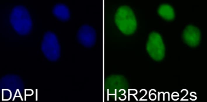 Polyclonal Rabbit anti-Human Histone H3 Antibody (Sym-Di-Methyl-Arg26, IF, WB)