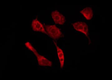 OR52A5 Antibody