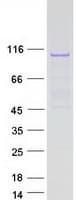 Human SIX4 Protein (Recombinant Myc-DDK (Flag))