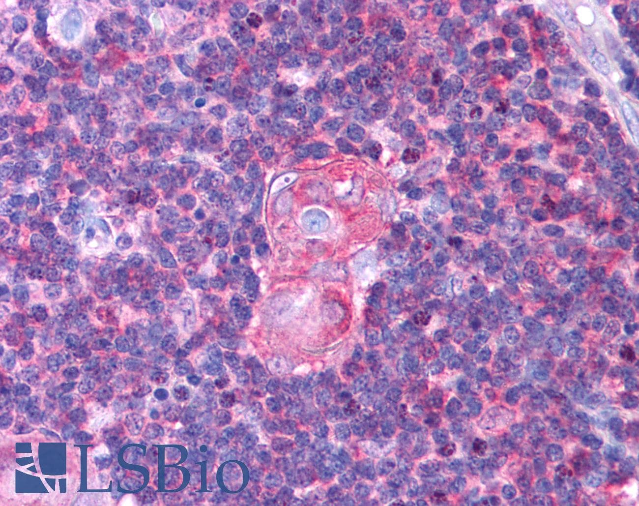 IHC-plus™ Polyclonal Rabbit anti-Human NFKB1 / NF-Kappa-B Antibody (N-Terminus, IHC, WB)