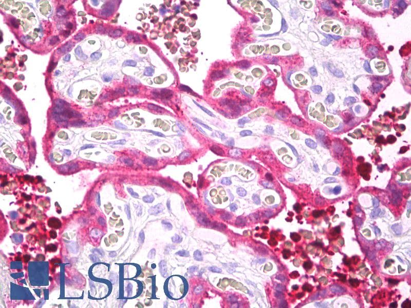 IHC-plus™ TGM2 / Transglutaminase 2 Antibody (Internal, clone EP2957)