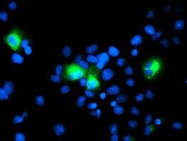 Monoclonal Mouse anti-Human ERBB2 / HER2 Antibody (clone OTI1C5, Carrier-free, aa676-1255, IHC, IF, WB)