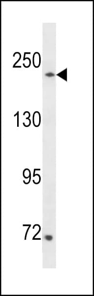 Polyclonal Rabbit anti-Human SETD1A / SET1 Antibody (aa927-956, WB)