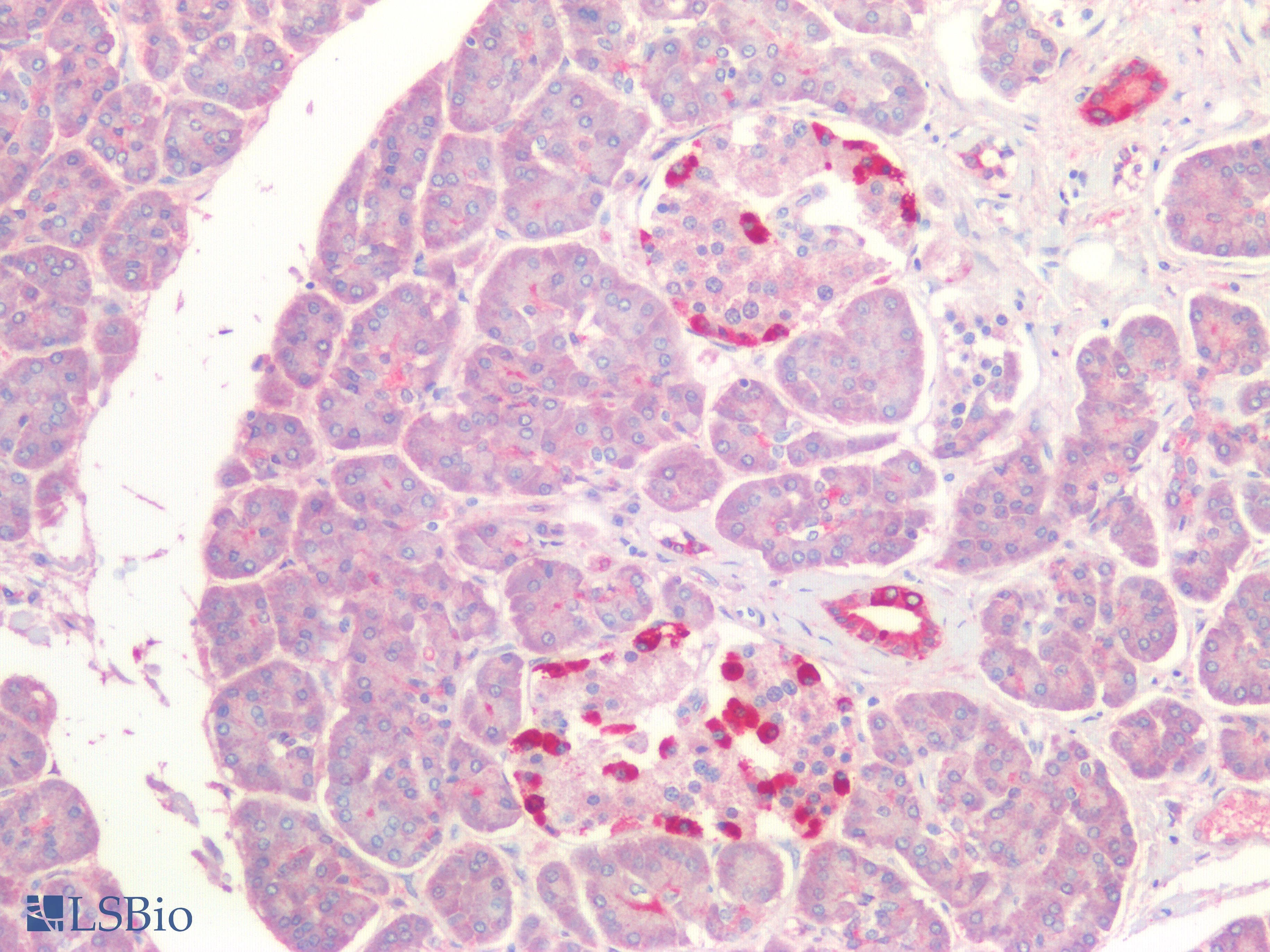 PathPlus™ KRT5 / CK5 / Cytokeratin 5 Antibody (C-Terminus)