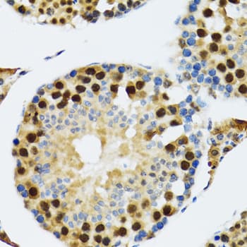 TRP32 / TXNL1 Antibody