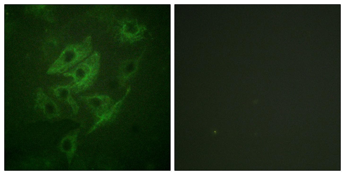 GRIN2A+GRIN2B Antibody (Ab-1246/1252)