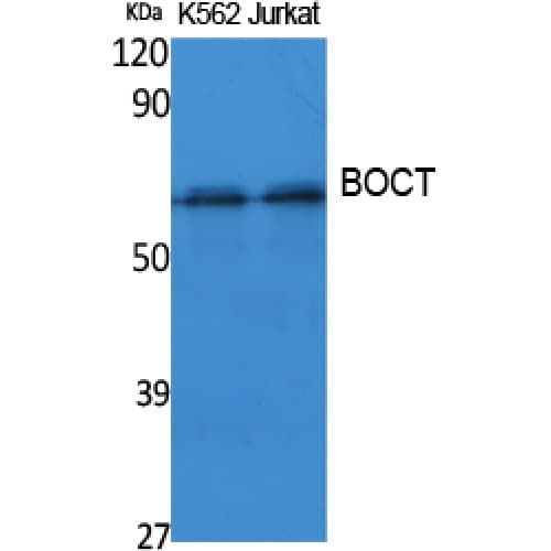 SLC22A17 Antibody (Internal)