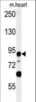Polyclonal Rabbit anti-Human LRRC36 Antibody (aa88-117, WB)