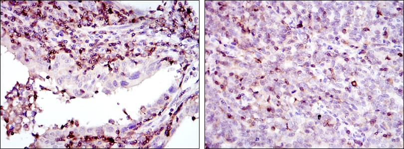 ADRBK1 / GRK2 Antibody (clone 3F8)