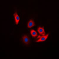 Polyclonal Rabbit anti-Human c-CBL Antibody (phospho-Tyr774, IHC, IF, WB)