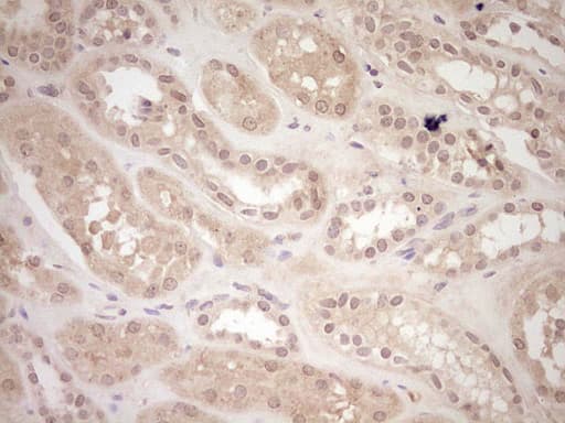 LPIN1 / Lipin 1 Antibody (aa1-274, clone OTI4C11)