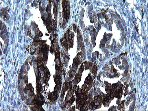 CD74 / CLIP Antibody (clone OTI1G10, Carrier-free)