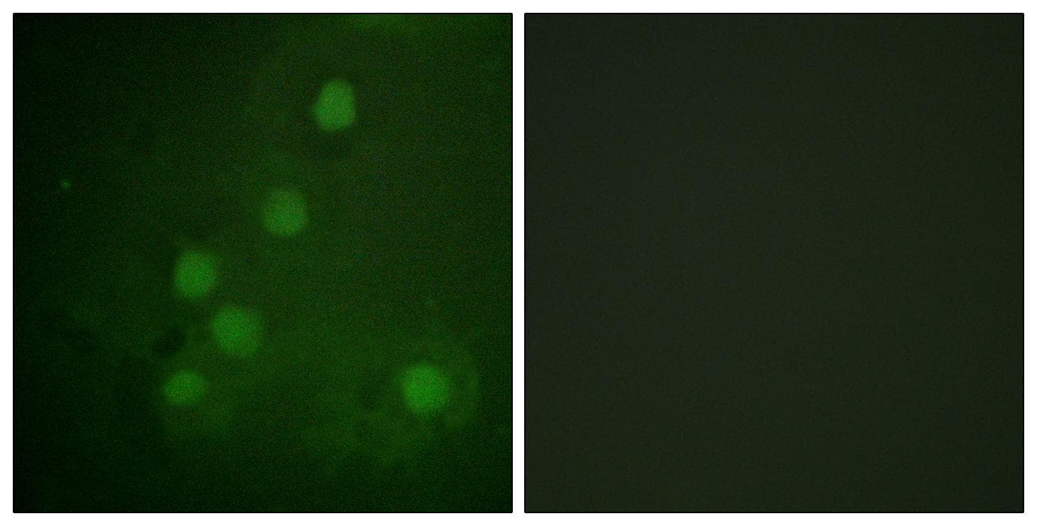 Polyclonal Rabbit anti-Human RAD52 Antibody (p104, IHC, IF, WB)