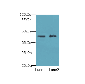 VPS45 Antibody